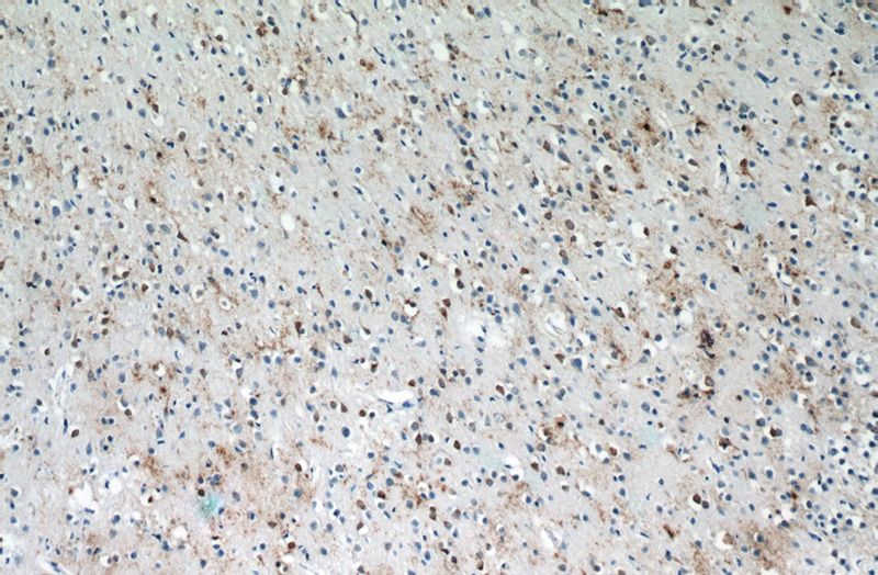 Immunohistochemistry of paraffin-embedded human brain tissue slide using Catalog No:111667(RABL4 Antibody) at dilution of 1:50 (under 10x lens)