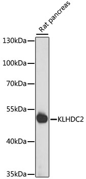 Western blot - KLHDC2 Polyclonal Antibody 