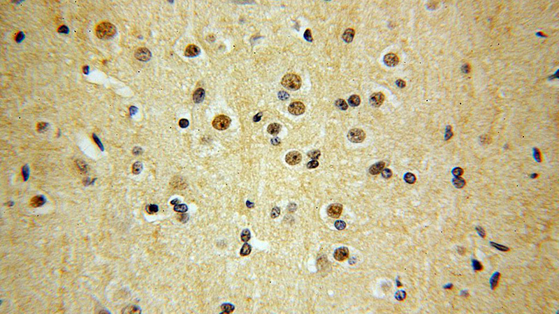 Immunohistochemical of paraffin-embedded human brain using Catalog No:115954(TEX10 antibody) at dilution of 1:200 (under 40x lens)