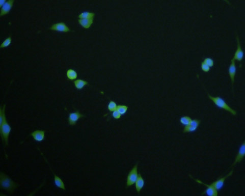 Fig1: ICC staining LNP (green) in SHG-44 cells. The nuclear counter stain is DAPI (blue). Cells were fixed in paraformaldehyde, permeabilised with 0.25% Triton X100/PBS.