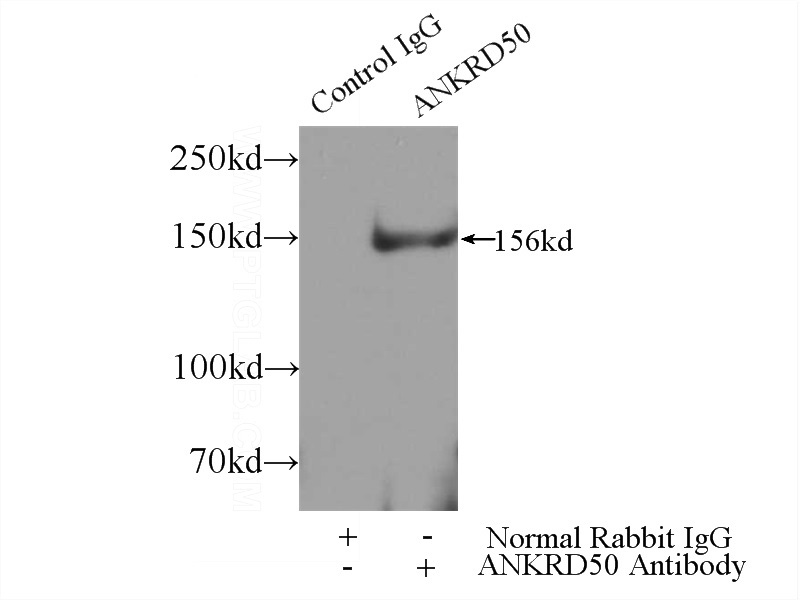 IP Result of anti-ANKRD50 (IP:Catalog No:108078, 5ug; Detection:Catalog No:108078 1:300) with HEK-293 cells lysate 4000ug.