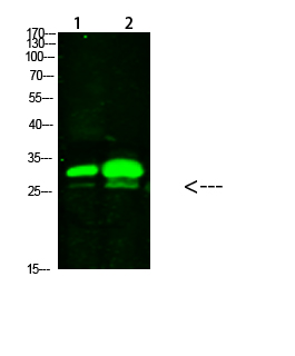 Fig1:; Western Blot analysis of 1,mouse-brain 2,mouse-spleen cells using primary antibody diluted at 1:1000(4°C overnight). Secondary antibody：Goat Anti-rabbit IgG IRDye 800( diluted at 1:5000, 25°C, 1 hour)