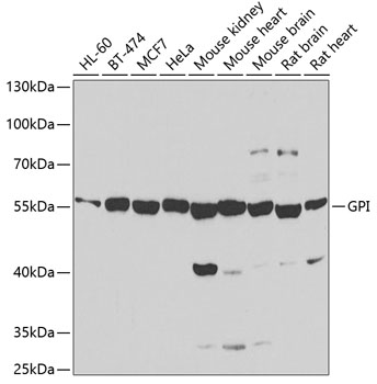 Western blot - GPI Polyclonal Antibody 