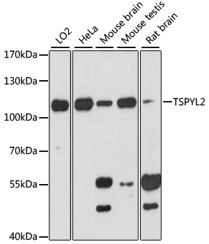 Western blot - TSPYL2 Polyclonal Antibody 