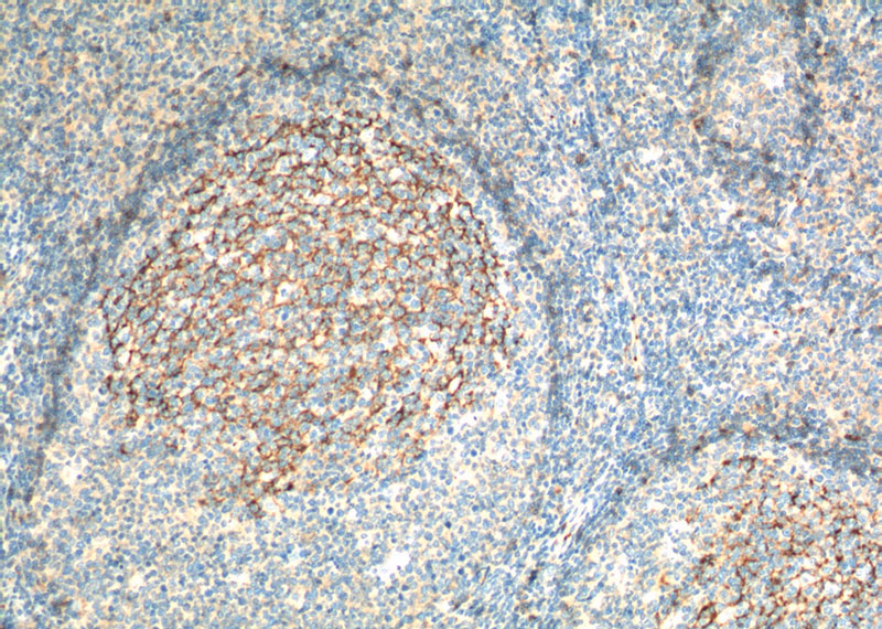 Immunohistochemistry of paraffin-embedded human tonsillitis tissue slide using Catalog No:107125(CD23,FCER2 Antibody) at dilution of 1:200 (under 10x lens). heat mediated antigen retrieved with Tris-EDTA buffer(pH9).
