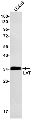 Western blot detection of LAT in U2OS cell lysates using LAT Rabbit mAb(1:500 diluted).Predicted band size:28kDa.Observed band size:36kDa.