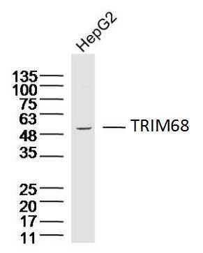 Fig2: Sample:; HepG2(Human) Cell Lysate at 40 ug; Primary: Anti-TRIM68 at 1/300 dilution; Secondary: IRDye800CW Goat Anti-Rabbit IgG at 1/20000 dilution; Predicted band size: 56 kD; Observed band size: 56 kD