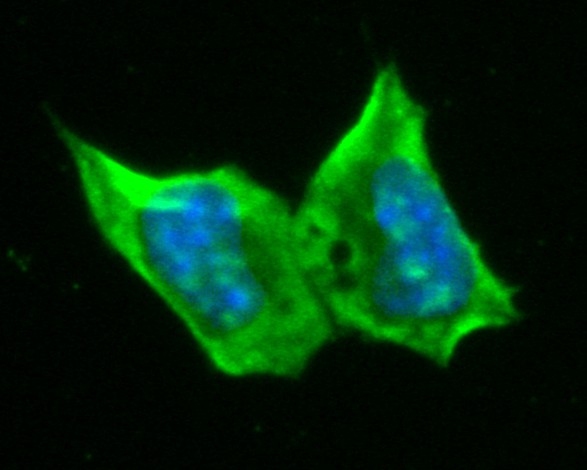 Fig3: ICC staining of RBPMS in F9 cells (green). Formalin fixed cells were permeabilized with 0.1% Triton X-100 in TBS for 10 minutes at room temperature and blocked with 1% Blocker BSA for 15 minutes at room temperature. Cells were probed with the primary antibody ( 1/100) for 1 hour at room temperature, washed with PBS. Alexa Fluor®488 Goat anti-Rabbit IgG was used as the secondary antibody at 1/1,000 dilution. The nuclear counter stain is DAPI (blue).