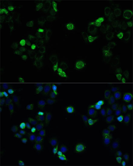 Immunofluorescence - MRP4 / ABCC4 Polyclonal Antibody 