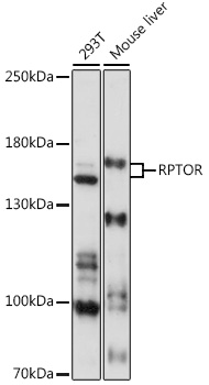 Western blot - RPTOR Polyclonal Antibody 