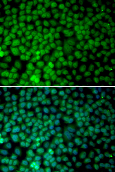 Immunofluorescence - RBX1 Polyclonal Antibody 