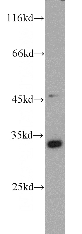 HeLa cells were subjected to SDS PAGE followed by western blot with Catalog No:114354(PYCR1 antibody) at dilution of 1:1000