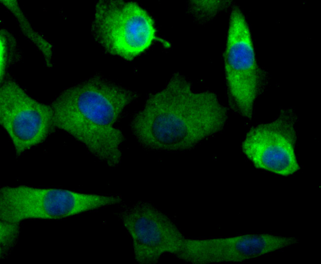 Fig1: ICC staining NaV1.7 in A549 cells (green). The nuclear counter stain is DAPI (blue). Cells were fixed in paraformaldehyde, permeabilised with 0.25% Triton X100/PBS.