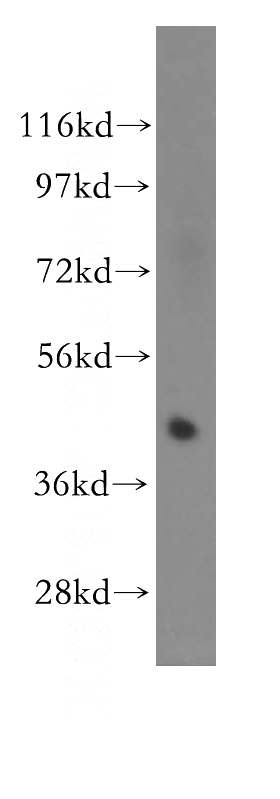 Jurkat cells were subjected to SDS PAGE followed by western blot with Catalog No:115113(SEPT1 antibody) at dilution of 1:400