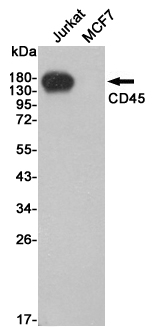 Western blot detection of CD45 in Jurkat and MCF7 cell lysates using CD45 mouse mAb (1:2000 diluted).Predicted band size:147KDa.Observed band size:180KDa.