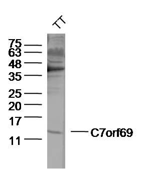 Fig1: Sample: TT(human)cell Lysate at 40 ug; Primary: Anti- C7orf69 at 1/300 dilution; Secondary: IRDye800CW Goat Anti-Rabbit IgG at 1/20000 dilution; Predicted band size: 12kD; Observed band size: 12 kD