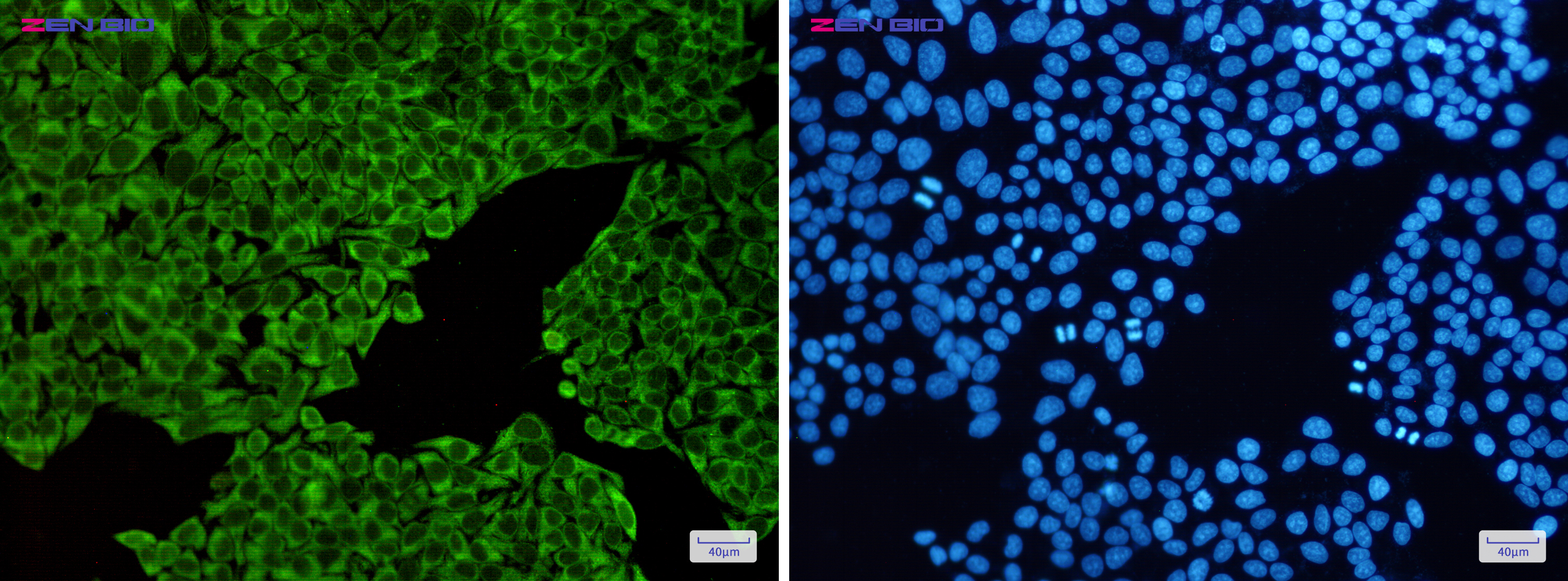 Immunocytochemistry of ENO1/ENO2/ENO3(green) in Hela cells using ENO1/ENO2/ENO3 Rabbit pAb at dilution 1/50, and DAPI(blue)