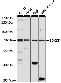 Western blot - SOCS5 Polyclonal Antibody 