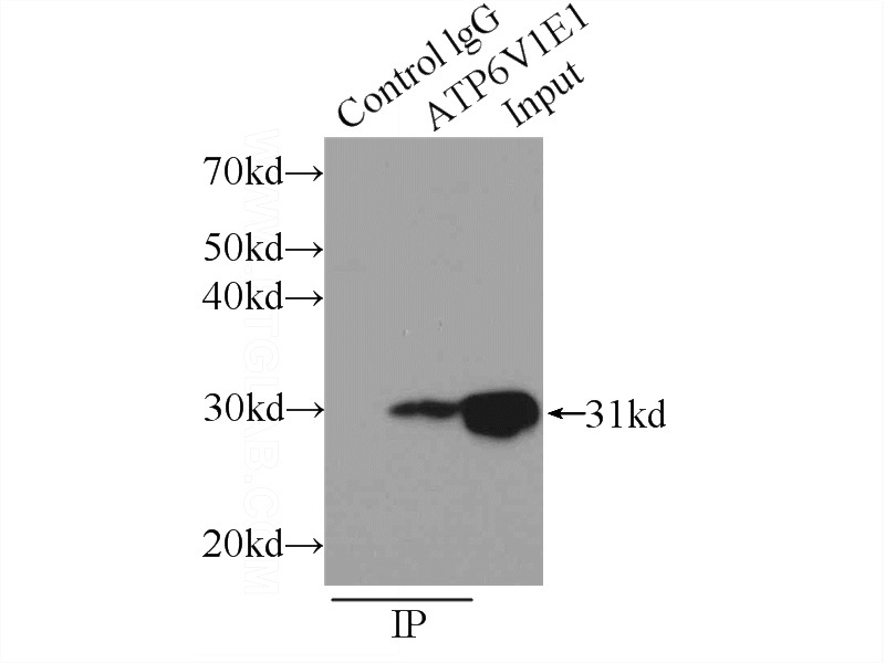 IP Result of anti-ATP6V1E1 (IP:Catalog No:108311, 3ug; Detection:Catalog No:108311 1:500) with mouse brain tissue lysate 6000ug.