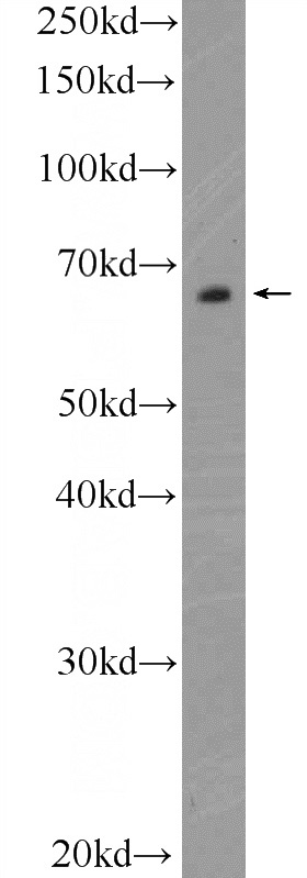 MDA-MB-453s cells were subjected to SDS PAGE followed by western blot with Catalog No:115934(TEAD4 Antibody) at dilution of 1:600