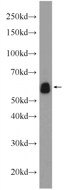 mouse brain tissue were subjected to SDS PAGE followed by western blot with Catalog No:110192(EIF3D Antibody) at dilution of 1:600