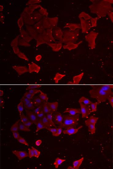 Immunofluorescence - FLCN Polyclonal Antibody 