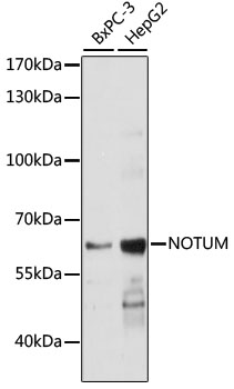 Western blot - NOTUM Polyclonal Antibody 