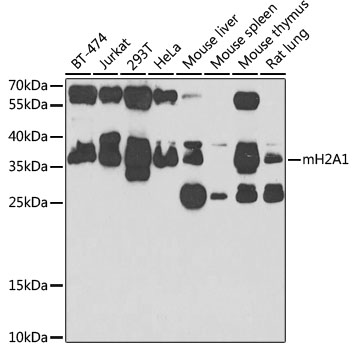 Western blot - mH2A1 Polyclonal Antibody 