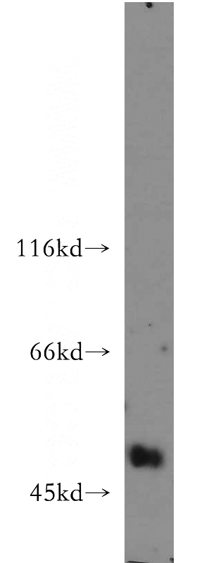 human testis tissue were subjected to SDS PAGE followed by western blot with Catalog No:116560(UGT3A2 antibody) at dilution of 1:500
