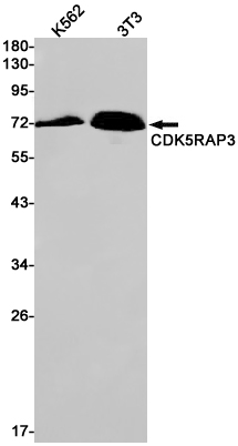 Western blot detection of CDK5RAP3 in K562,Hela cell lysates using CDK5RAP3 Rabbit pAb(1:1000 diluted).Predicted band size:57kDa.Observed band size:70kDa.