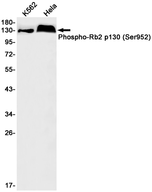 Western blot detection of Rb2 p130 (Phospho-Ser952) in K562,Hela cell lysates using Rb2 p130 (Phospho-Ser952) Rabbit pAb(1:1000 diluted).Predicted band size:128kDa.Observed band size:130kDa.