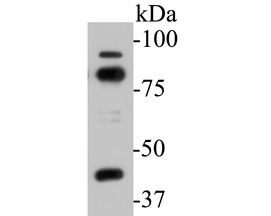 Fig1: Western blot analysis of SPATIAL on K562 cell lysates. Proteins were transferred to a PVDF membrane and blocked with 5% BSA in PBS for 1 hour at room temperature. The primary antibody ( 1/500) was used in 5% BSA at room temperature for 2 hours. Goat Anti-Rabbit IgG - HRP Secondary Antibody (HA1006) at 1:5,000 dilution was used for 1 hour at room temperature.
