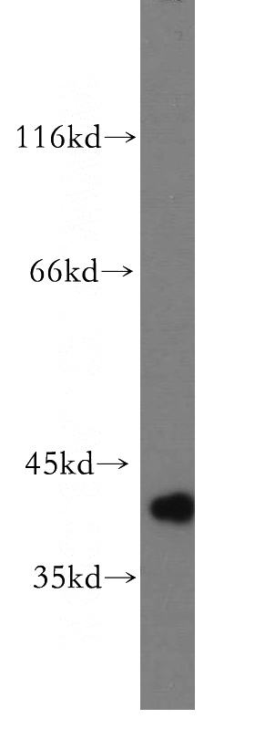 HL-60 cells were subjected to SDS PAGE followed by western blot with Catalog No:111641(NFKBIA antibody) at dilution of 1:500
