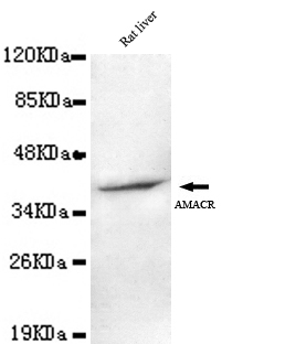 Western blot detection of AMACR(C-terminus) in Rat Liver lysates using AMACR(C-terminus) mouse mAb (1:1000 diluted).Predicted band size: 42KDa.Observed band size: 42KDa.