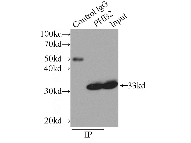 IP Result of anti-PHB2 (IP:Catalog No:114217, 3ug; Detection:Catalog No:114217 1:1000) with HeLa cells lysate 1840ug.