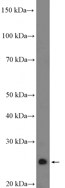 mouse liver tissue were subjected to SDS PAGE followed by western blot with Catalog No:110432(F8 Antibody) at dilution of 1:300
