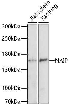 Western blot - NAIP Polyclonal Antibody 