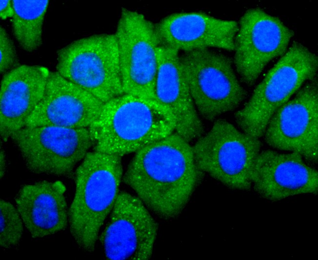 Fig3:; ICC staining of IGF2 in HepG2 cells (green). Formalin fixed cells were permeabilized with 0.1% Triton X-100 in TBS for 10 minutes at room temperature and blocked with 10% negative goat serum for 15 minutes at room temperature. Cells were probed with the primary antibody ( 1/50) for 1 hour at room temperature, washed with PBS. Alexa Fluor®488 conjugate-Goat anti-Rabbit IgG was used as the secondary antibody at 1/1,000 dilution. The nuclear counter stain is DAPI (blue).