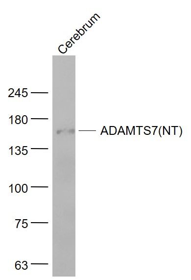 Fig3: Sample:; Cerebrum (Mouse) Lysate at 40 ug; Primary: Anti- ADAMTS7(NT) at 1/1000 dilution; Secondary: IRDye800CW Goat Anti-Rabbit IgG at 1/20000 dilution; Predicted band size: 158 kD; Observed band size: 158 kD