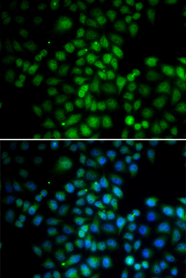 Immunofluorescence - C11orf30 Polyclonal Antibody 