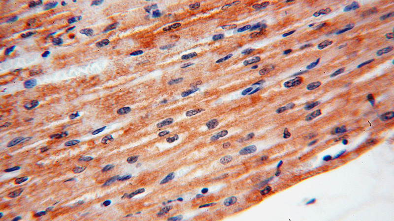 Immunohistochemical of paraffin-embedded human heart using Catalog No:116996(XPR1 antibody) at dilution of 1:100 (under 40x lens)
