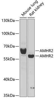 Western blot - AMHR2 Polyclonal Antibody 