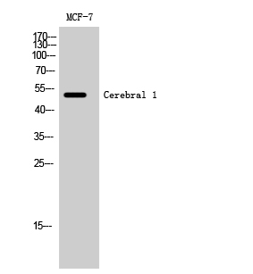 Fig1:; Western Blot analysis of MCF-7 cells using Cerebral 1 Polyclonal Antibody cells nucleus extracted by Minute TM Cytoplasmic and Nuclear Fractionation kit (SC-003,Inventbiotech,MN,USA).