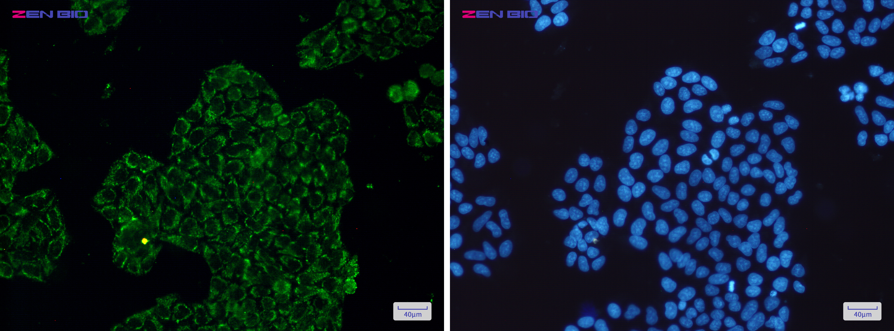 Immunocytochemistry of CLIC4(green) in Hela cells using CLIC4 Rabbit mAb at dilution 1/50, and DAPI(blue)