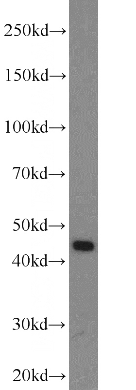SKOV-3 cells were subjected to SDS PAGE followed by western blot with Catalog No:114180(PREB antibody) at dilution of 1:600
