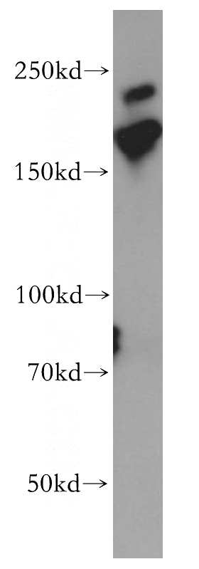 Jurkat cells were subjected to SDS PAGE followed by western blot with Catalog No:112980(MYO18A antibody) at dilution of 1:6000