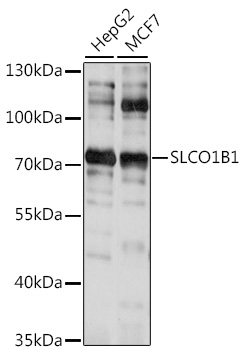 Western blot - SLCO1B1 Polyclonal Antibody 
