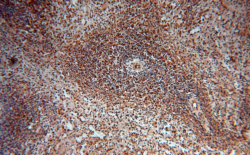 Immunohistochemical of paraffin-embedded human spleen using Catalog No:113002(MYSM1-Specific antibody) at dilution of 1:100 (under 10x lens)