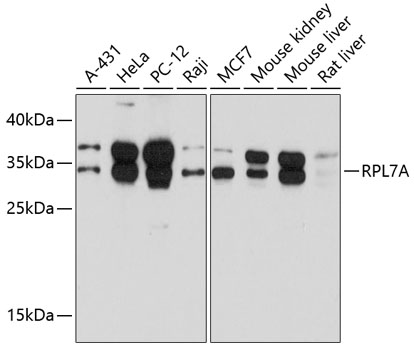 Western blot - RPL7A Polyclonal Antibody 
