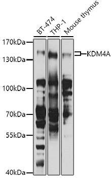 Western blot - KDM4A Polyclonal Antibody 